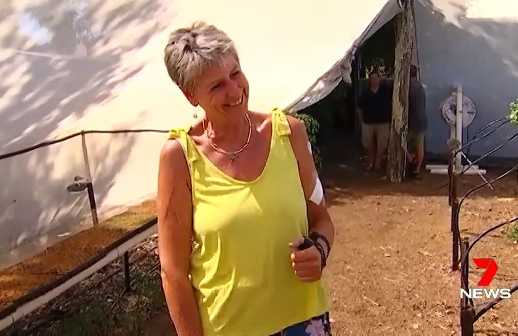 Patsy Brown shows off her injuries