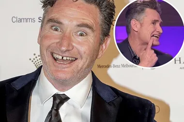 Dave Hughes reveals how he fixed his ‘crackhead’ smile