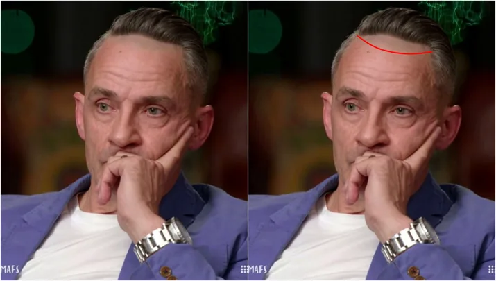Steve's hairline