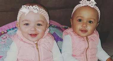 Rare biracial twins – one is black and the other white