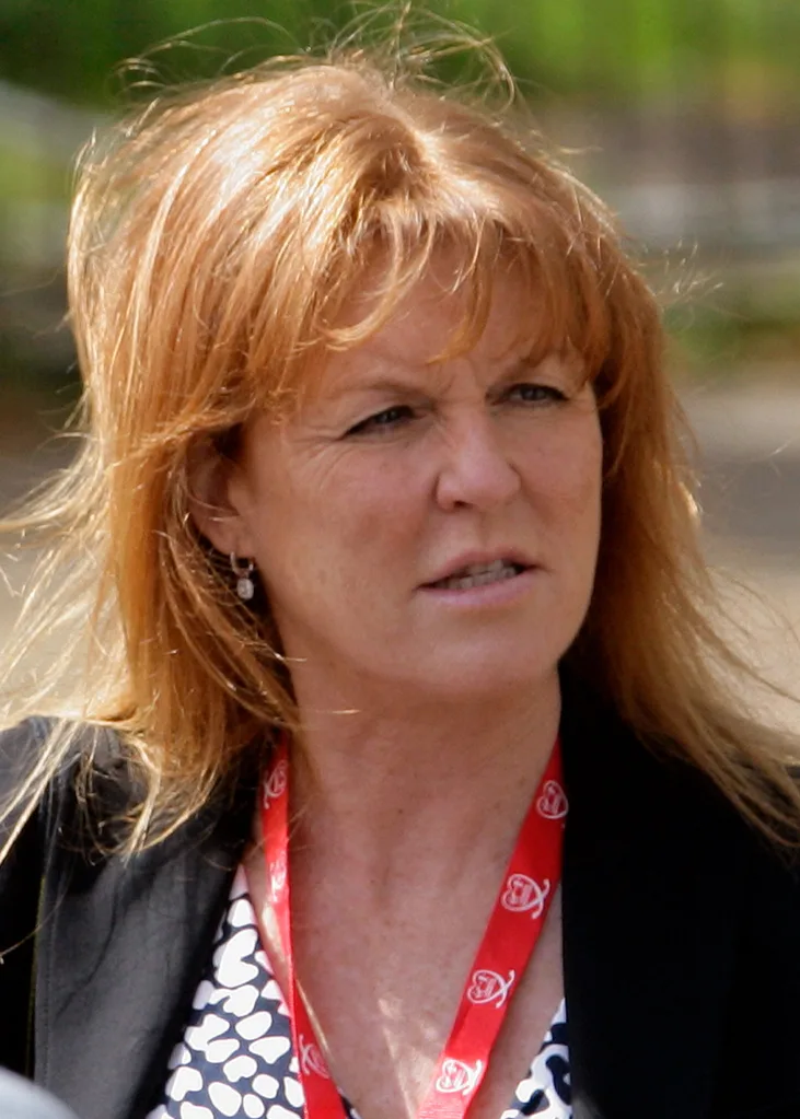 Fergie looking tired health