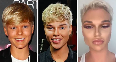 Jack Vidgen’s remarkable before and after transformation