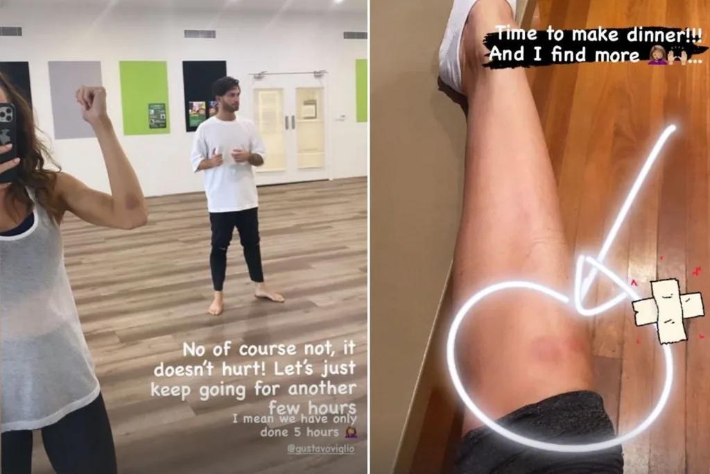 kyly clarke dancing with the stars injuries