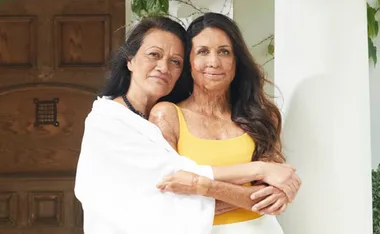 Meet the woman behind Turia Pitt’s courage: her mother Célestine Vaite