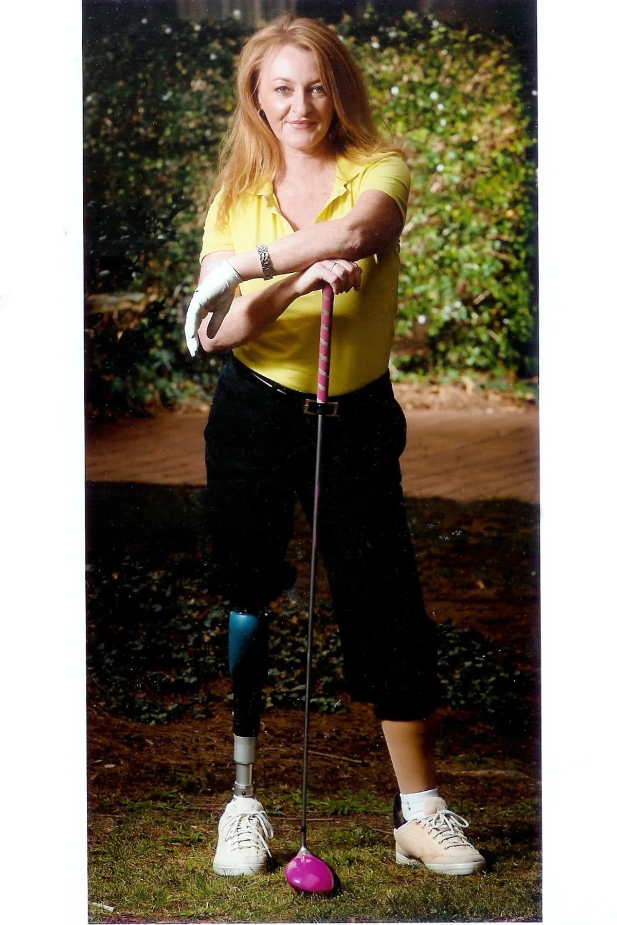 Becoming an amputee has not stopped Melissa's active lifestyle. Here she leans on her bright pink gold club.