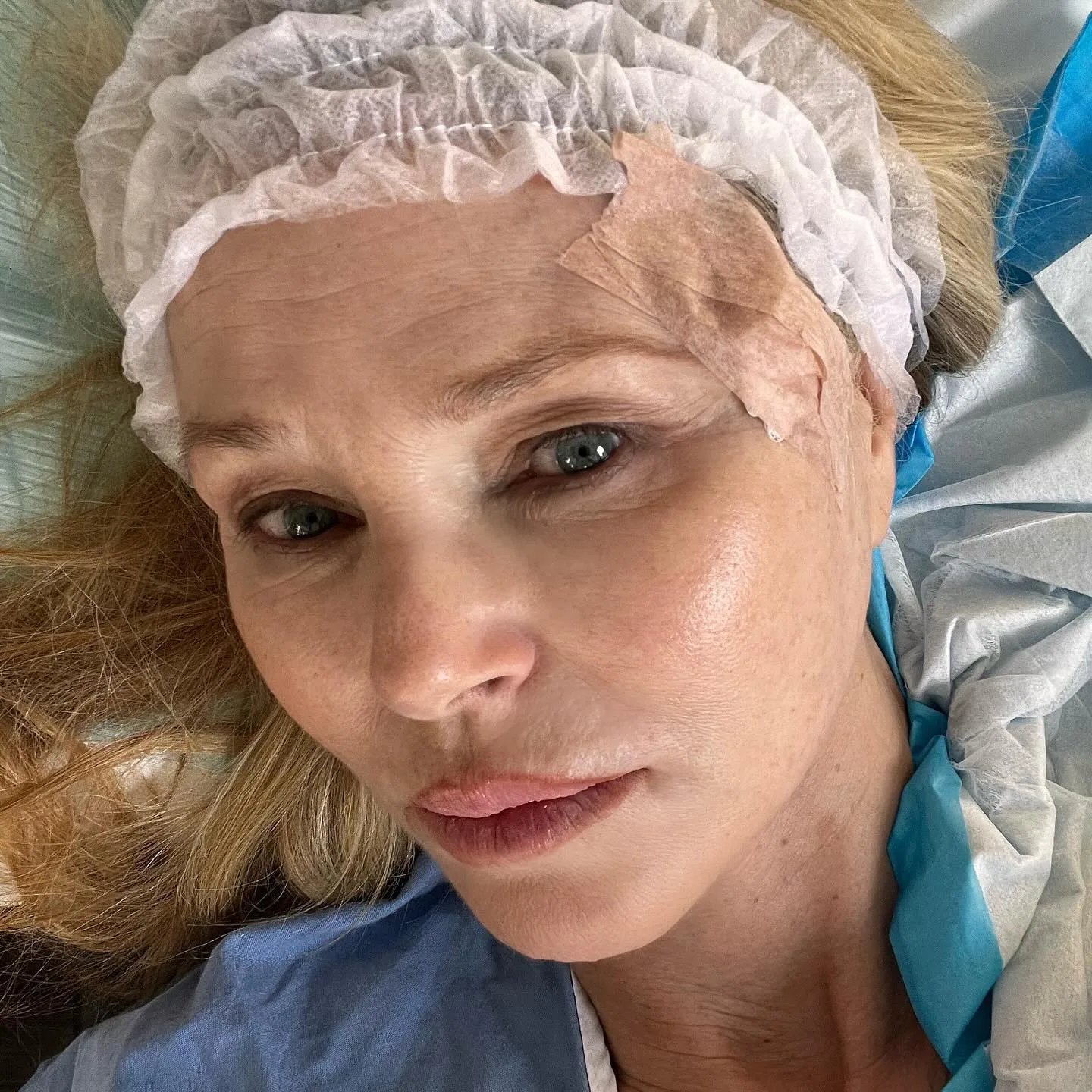 christie brinkley cancer