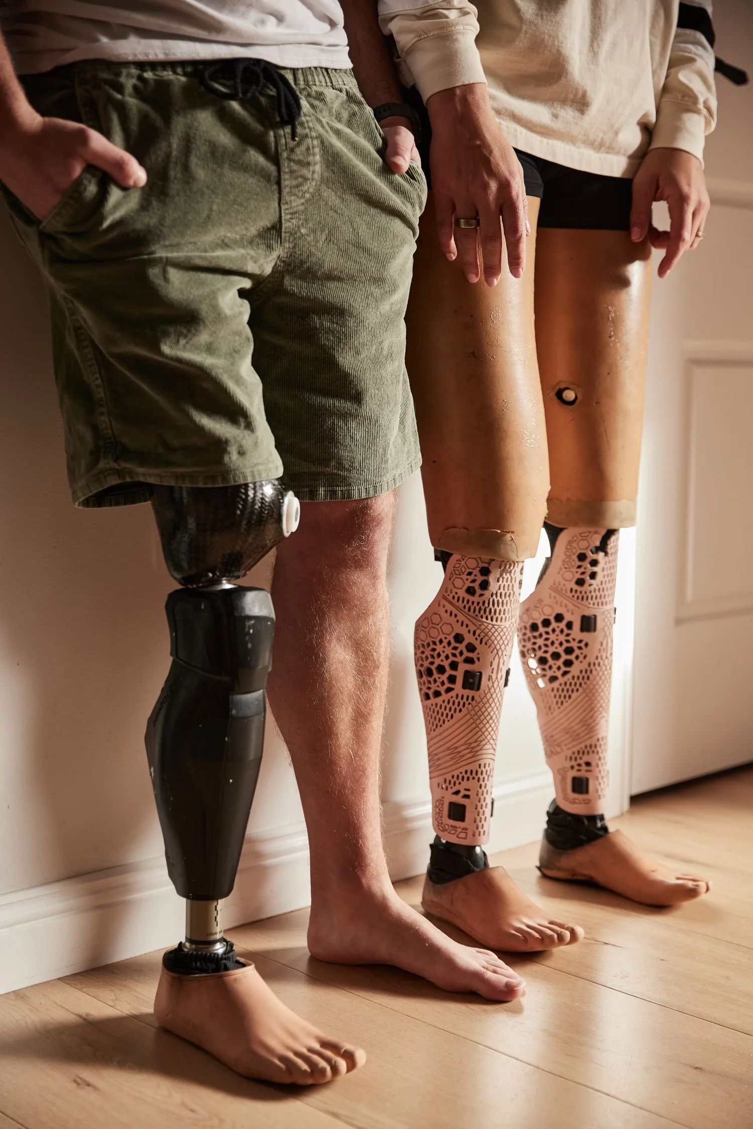 A man and woman with prosthetic legs stand against a wall.