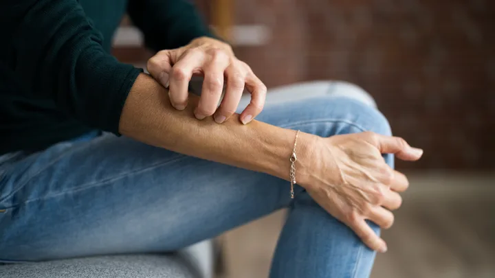 Woman scratching skin itchy
