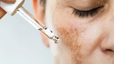 Pigmentation serum