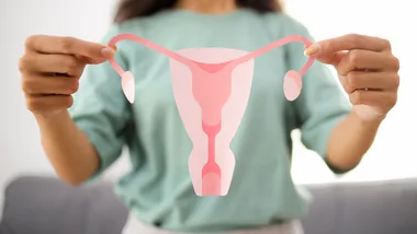 Ovarian diagram