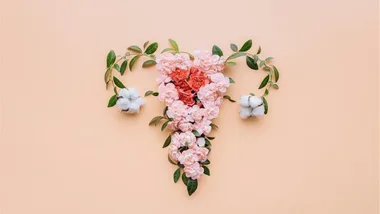 Endometriosis