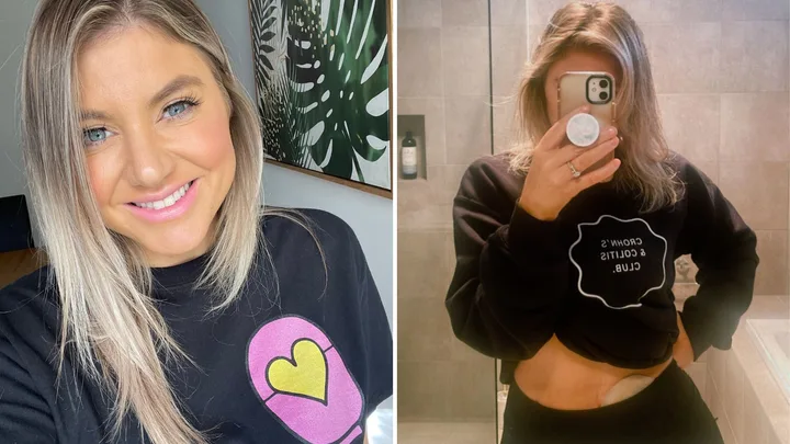 ‘Bed to toilet, bed to toilet’: The reality of living with Crohn’s disease