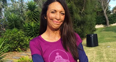Turia Pitt Announces She Is Pregnant!