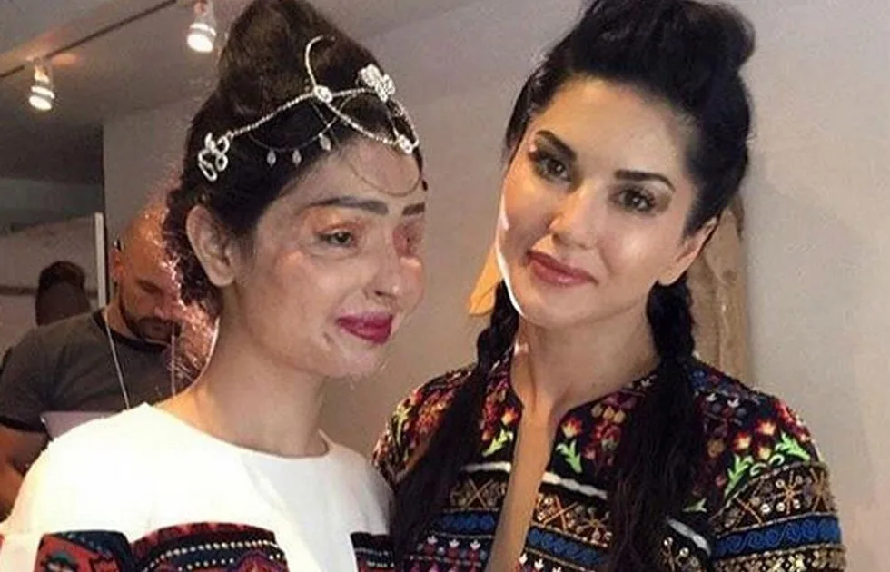 Indian Acid Attack Survivor walks at NYFW