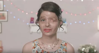 This Beauty Vlogger Is Creating Tutorials For Acid Attack Survivors