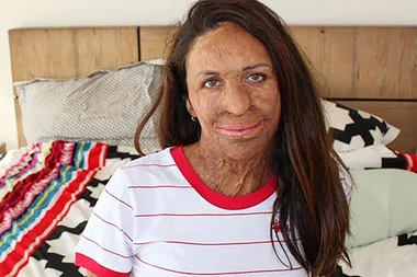 Turia Pitt Opens Up About The Birth Of Her First Child