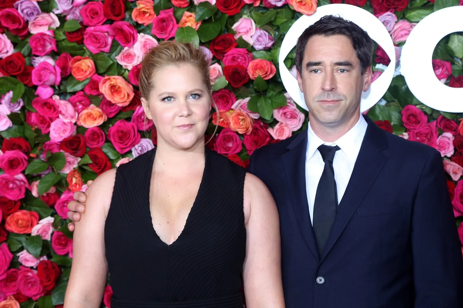 Amy Schumer Is Pregnant With Her First Child