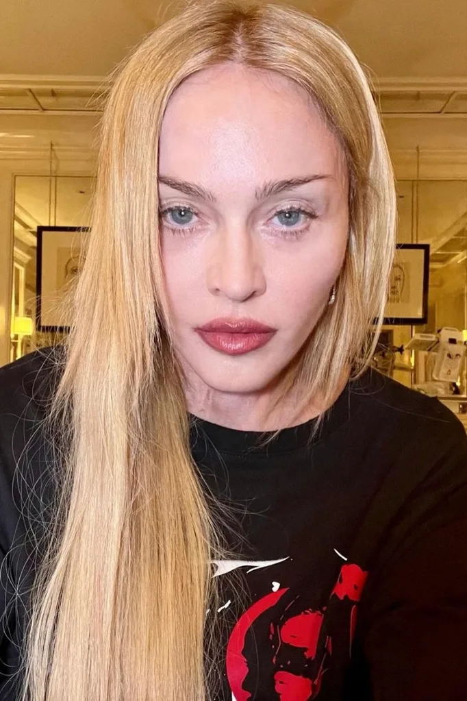 madonna-instagram-selfie-recover-after-icu