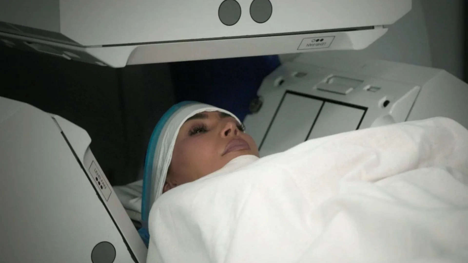 Kim Kardashian brain aneurysm