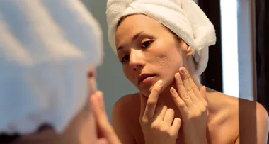 How To Get Rid Of Acne Scars, According To A Dermatologist