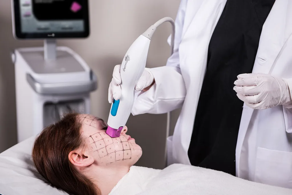 Thermage FLX treatment face