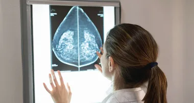 Should We Be Told If Our Breasts Are ‘Dense’?