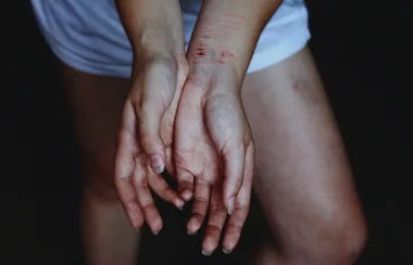 Young doctor and victim of Tinder date speaks out