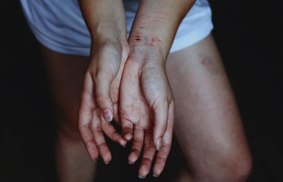 Rape alcohol blame