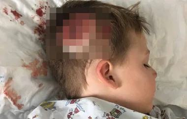 Mother Shares Heartbreaking Photos Of Her Son To Combat Bullying