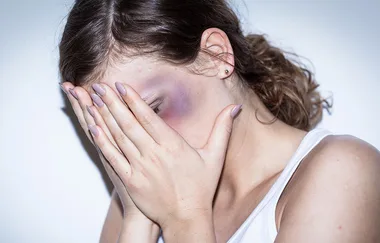 Over 6000 women a year are being hospitalised from assault