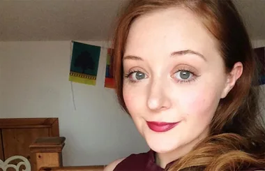 Mum Shares Painful Photo Of Mastitis To Help Others