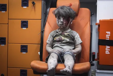 This Is What The Injured Boy From Aleppo Looks Like Now