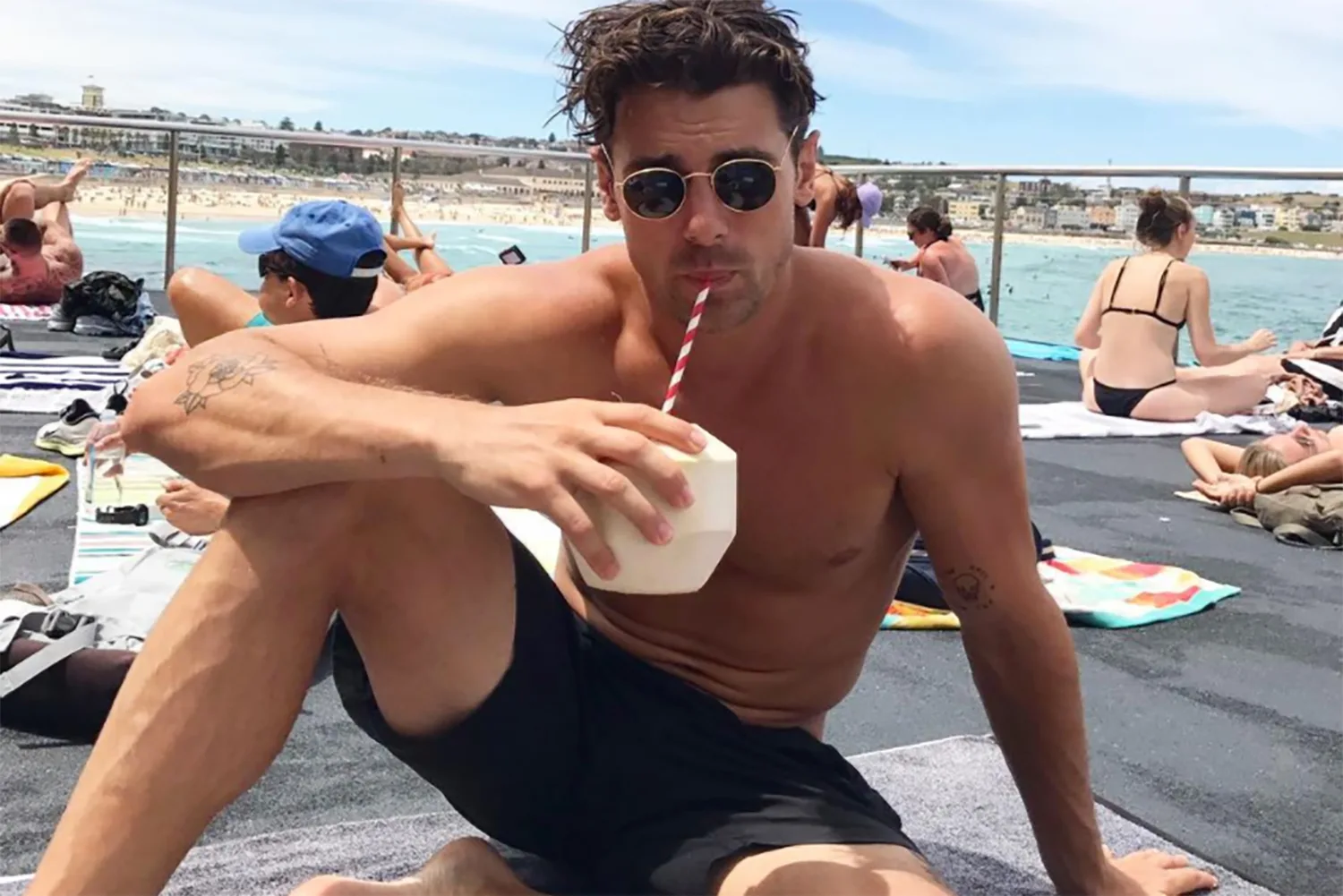 Matty J Opens Up About Cosmetic Surgery Before ‘The Bachelor’