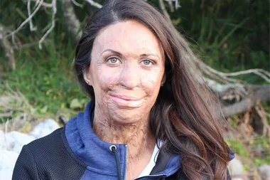 Turia Pitt Shares A Bikini Selfie To Show Off Her Pregnant Belly