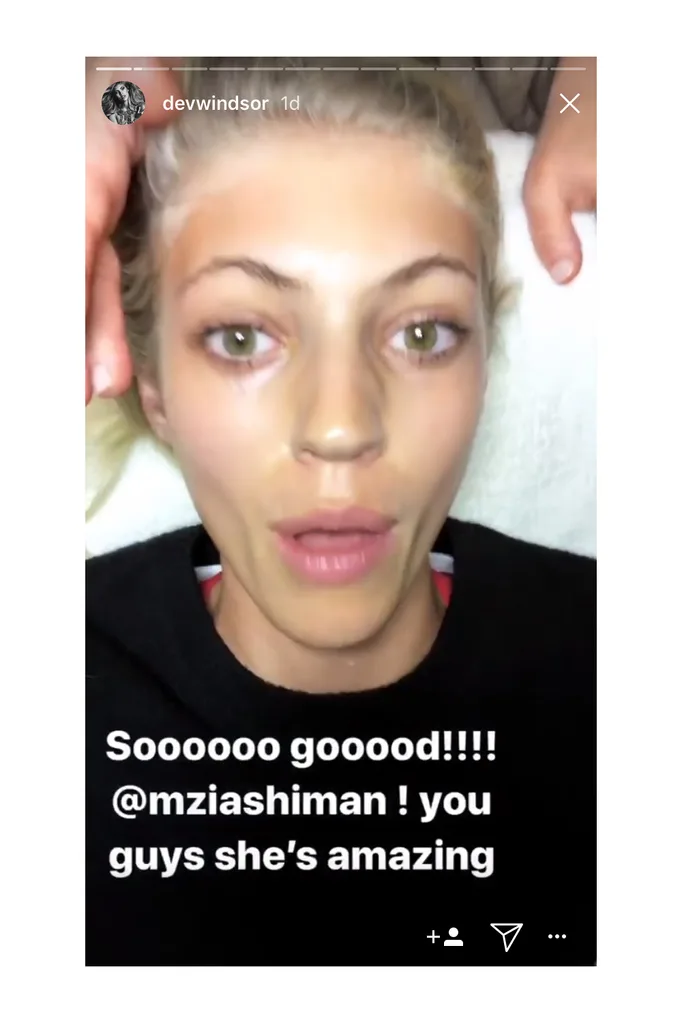 devin windsor oxygen facials