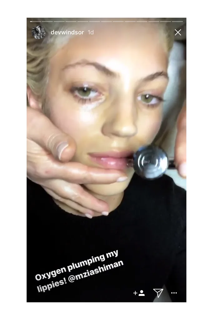 devon windsor victorias secret skin