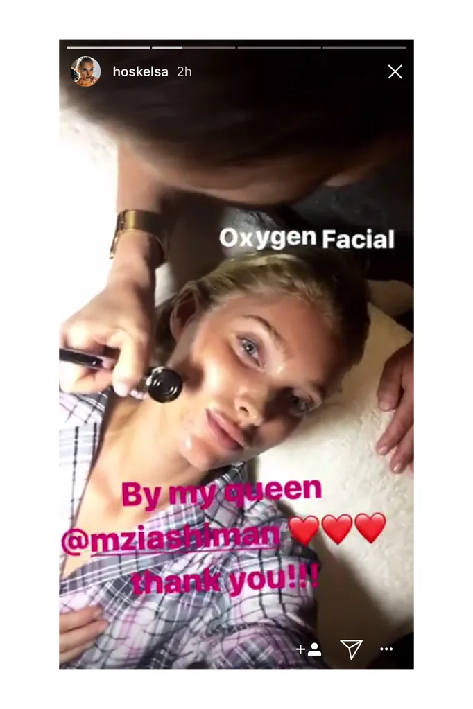 elsa hosk oxygen facial