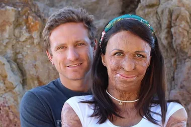 Turia Pitt And Michael Hoskin Have Welcomed Their First Baby