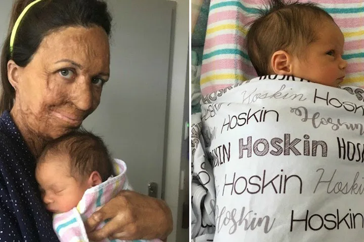 Turia Pitt Newsletter.