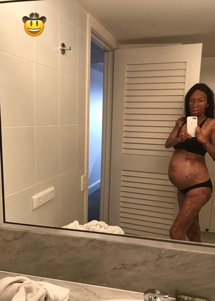 Turia Pitt