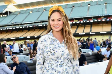 Chrissy Teigen Shares One Of Her Weirdest Treatments Yet