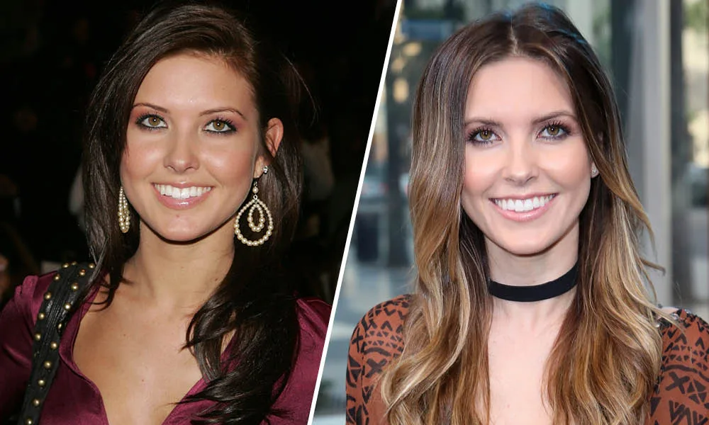 Audrina Patridge