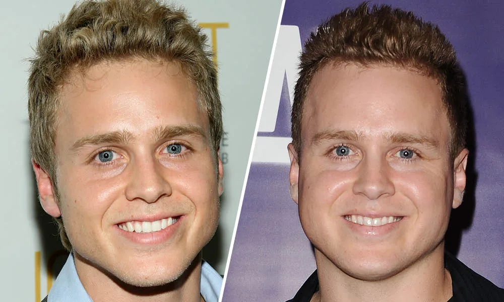 Spencer Pratt