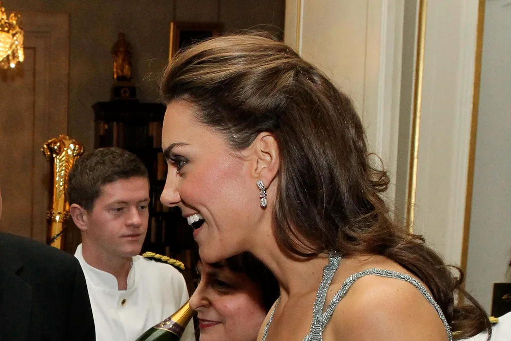 Kate Middleton Scar