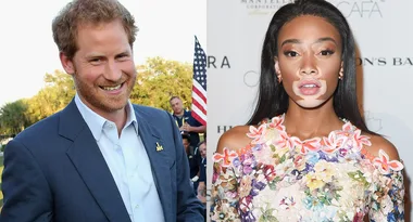 Prince Harry Photobombs Model Winnie Harlow’s Selfie