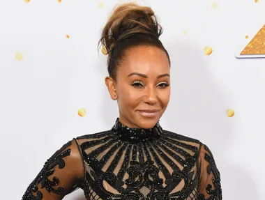 Mel B Has Been Hospitalised With Two Broken Ribs And A Severed Hand