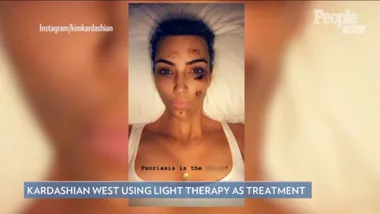 Kim Kardashian Shares Selfie Showing Her Battle with Psoriasis and How She Treats It