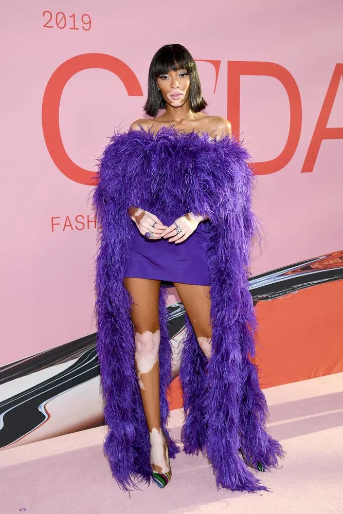 Winnie Harlow