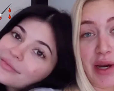 Kylie Jenner and Stassie get matching surgery