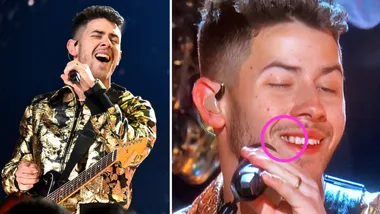 Nick Jonas performs at the Grammys with food in his teeth